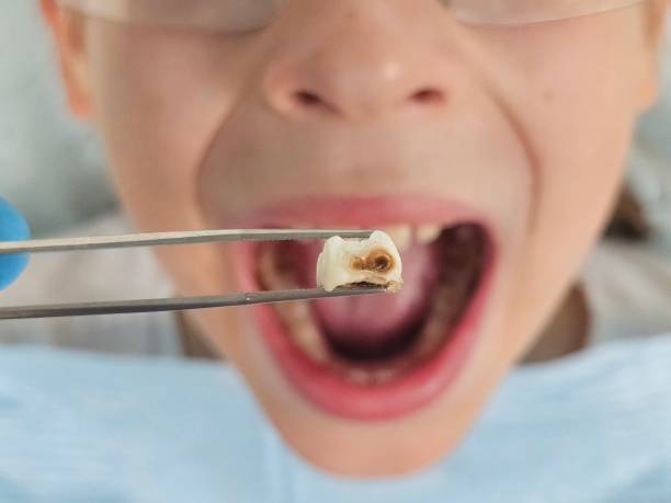 Best Emergency TMJ Treatment in Manteno, IL