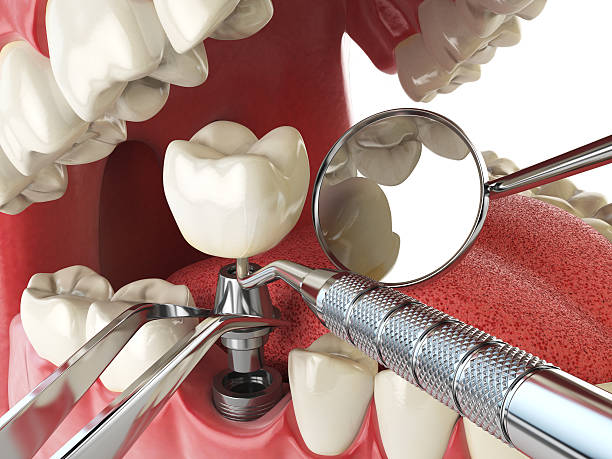 Best Emergency Treatment for Dental Infections or Abscesses in Manteno, IL